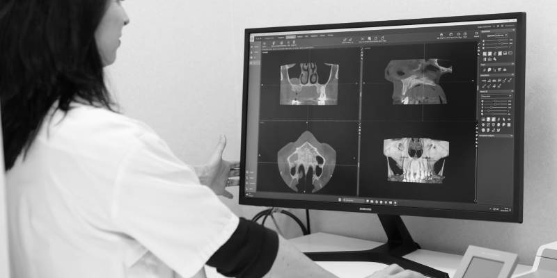 Imagerie, planification 3D & chirurgie guidée